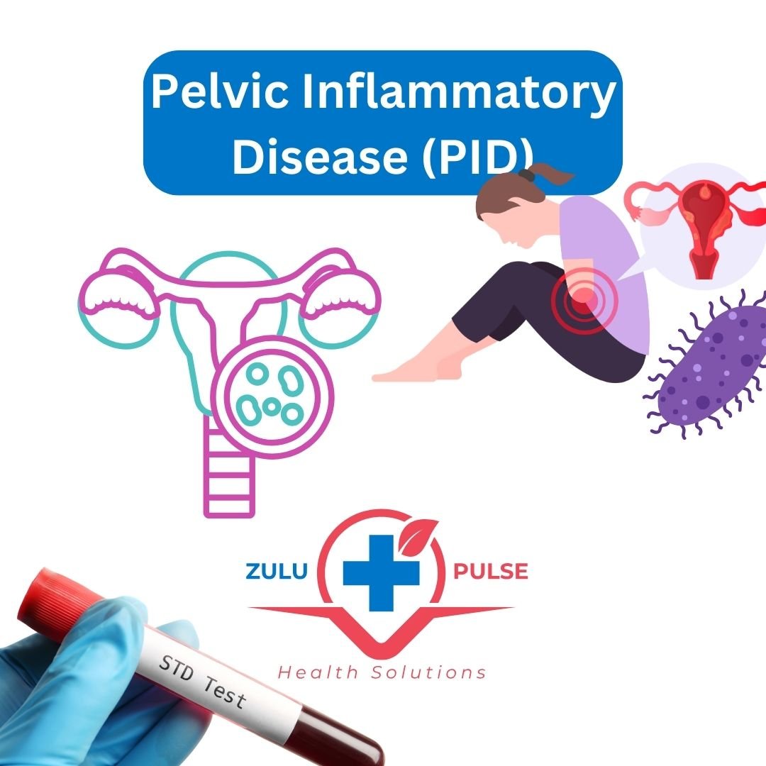 Pelvic Inflammatory disease by zulu pulse health solutions