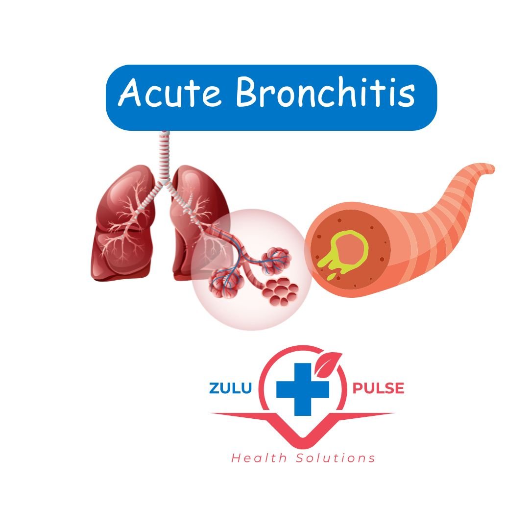 inflamed bronchi in acute bronchitis