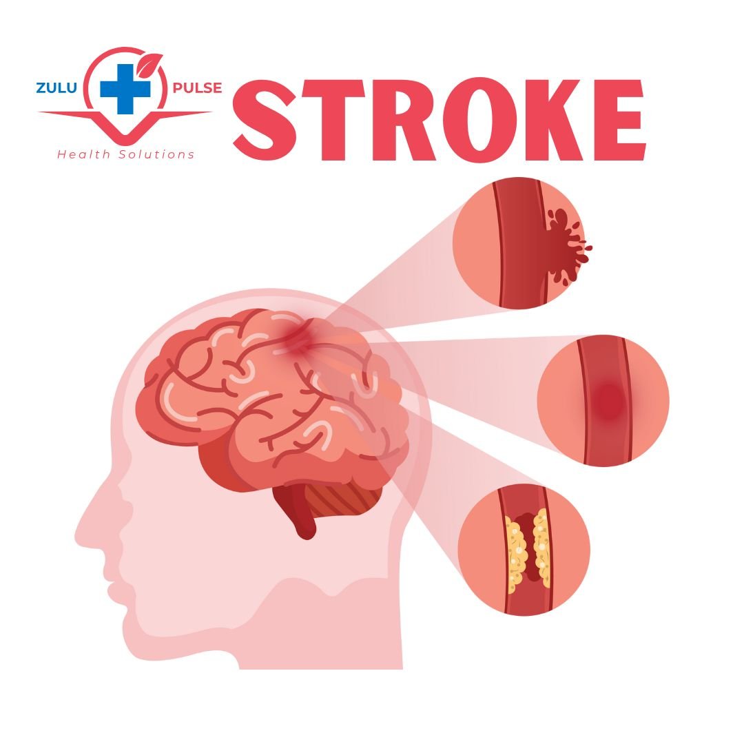 Stroke by Zulu Pulse