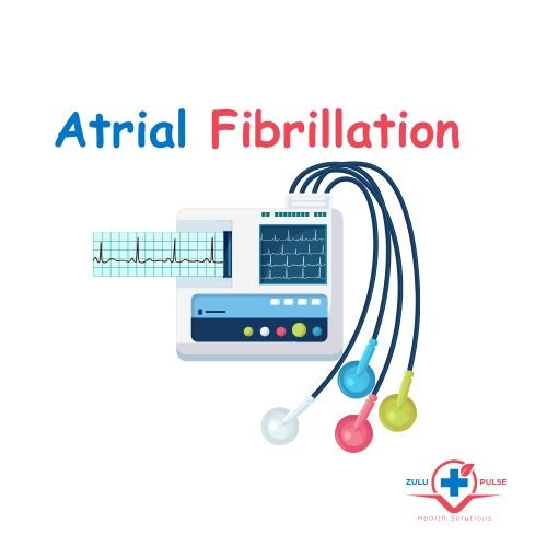 atrial fibrillation by zulu pulse